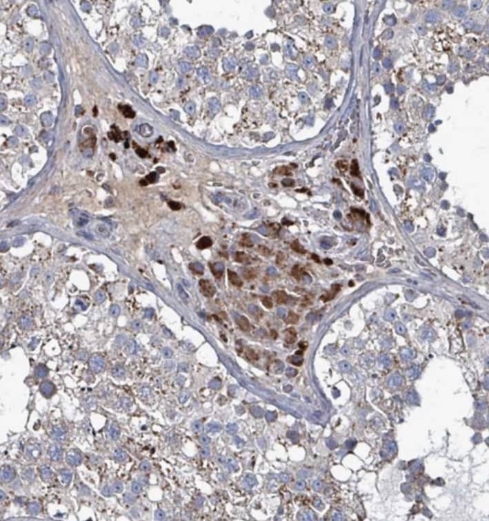 Staining of human testis shows strong cytoplasmic positivity in Leydig cells.