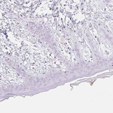 Immunohistochemistry-Paraffin: CLEC3A Antibody [NBP2-30595] -Staining of human skin show negative cytoplasmic positivity in fibroblasts as expected.