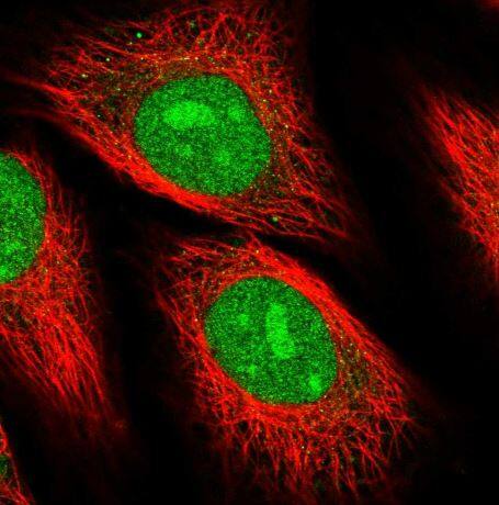 Immunocytochemistry/Immunofluorescence: Replication Termination Factor 2 Antibody [NBP2-30645] -Staining of human cell line HeLa shows localization to nucleus & nucleoli.
