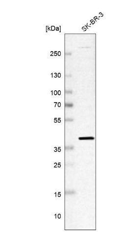 Western Blot: Replication Termination Factor 2 Antibody [NBP2-30645] -Analysis in human cell line SK-BR-3.