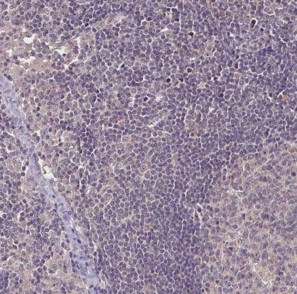 Immunohistochemistry-Paraffin: RPL38 Antibody [NBP2-30693] - Staining of human lymph node shows no cytoplasmic positivity in non-germinal center cells as expected.