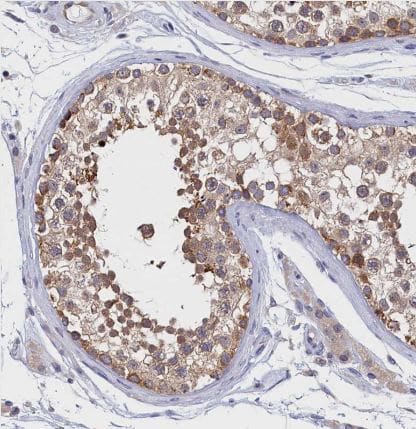 Immunohistochemistry-Paraffin PGPase Antibody - BSA Free