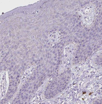 Immunohistochemistry-Paraffin: GBX1 Antibody [NBP2-30817] -Staining of human skin shows no positivity in squamous epithelial cells as expected.