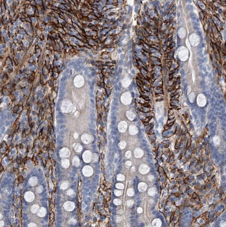 Immunohistochemistry-Paraffin ALG14 Antibody - BSA Free
