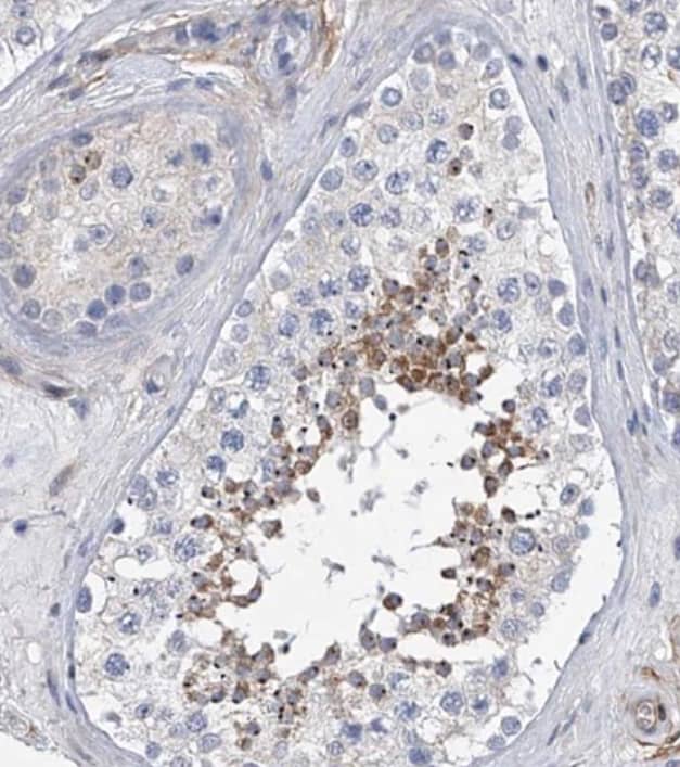 Immunohistochemistry-Paraffin ALG14 Antibody - BSA Free