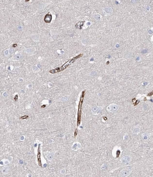 Immunohistochemistry-Paraffin ALG14 Antibody - BSA Free