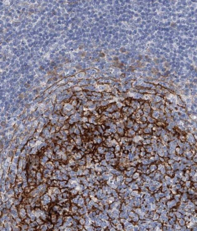 Immunohistochemistry-Paraffin ALG14 Antibody - BSA Free