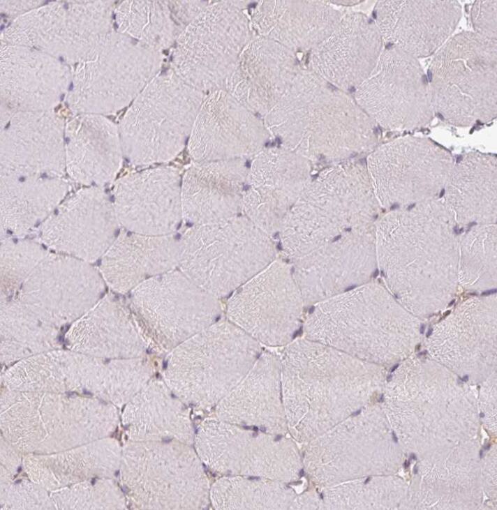 Immunohistochemistry-Paraffin Agpat4 Antibody - BSA Free