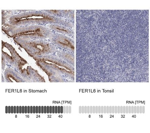 Fer-1-like protein 6 Antibody [NBP2-31004] -Analysis in human stomach and tonsil tissues using NBP2-31004antibody. Corresponding FER1L6 RNA-seq data are presented for the same tissues.