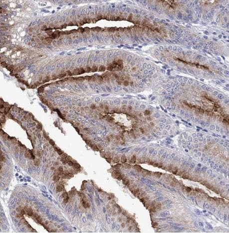 Fer-1-like protein 6 Antibody [NBP2-31004] - Staining of human stomach shows strong membranous positivity in glandular cells.