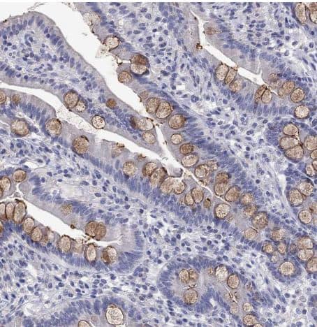 Fer-1-like protein 6 Antibody [NBP2-31004] - Staining of human small intestine shows strong membranous positivity in goblet cells.