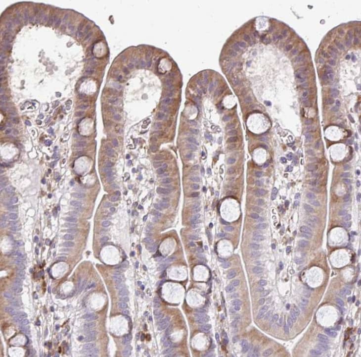 Staining of human duodenum shows moderate cytoplasmic positivity in glandular cells.