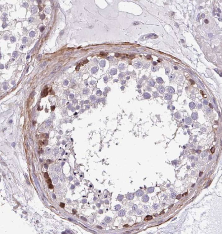  Staining of human testis shows moderate cytoplasmic positivity in cells in seminiferous ducts.