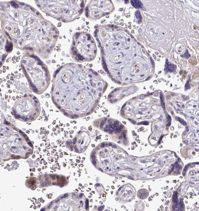  Staining of human placenta shows weak cytoplasmic positivity in trophoblastic cells.