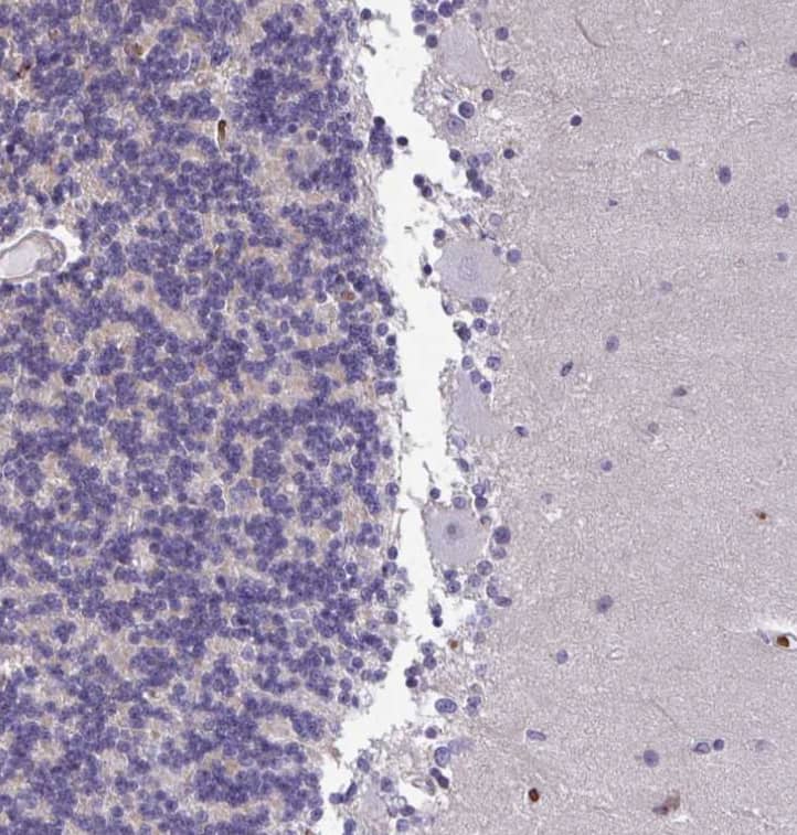  Staining of human cerebellum shows no positivity in Purkinje cells.