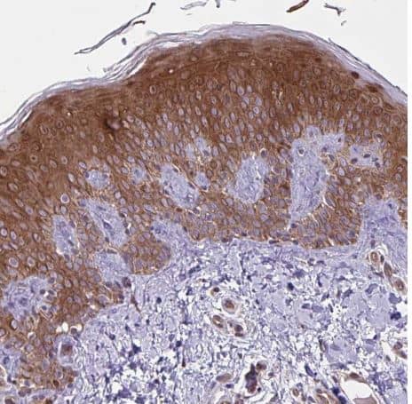 Immunohistochemistry-Paraffin: GLTP Antibody [NBP2-31642] -Staining of human skin shows strong cytoplasmic positivity in squamous epithelial cells.