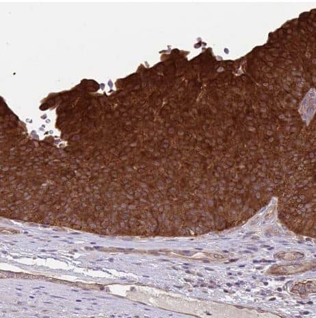 Immunohistochemistry-Paraffin: GLTP Antibody [NBP2-31642] -Staining of human urinary bladder shows strong cytoplasmic positivity in urothelial cells. 