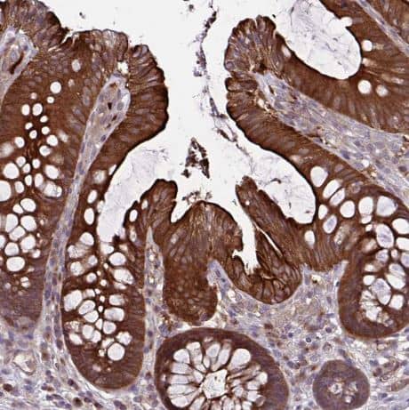 Immunohistochemistry-Paraffin: GLTP Antibody [NBP2-31642] -Staining of human colon shows strong cytoplasmic positivity in glandular cells.