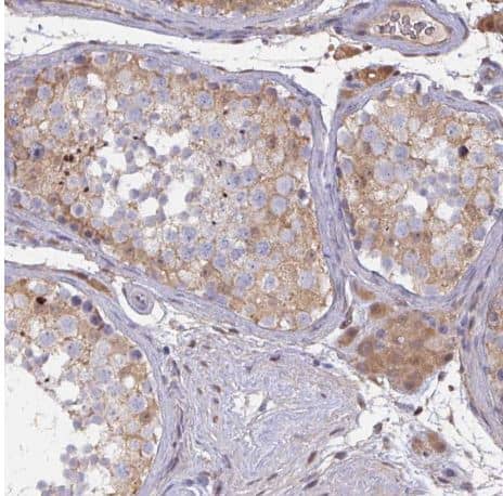 Staining of human testis shows weak cytoplasmic positivity in cells in seminiferous ducts and Leydig cells.