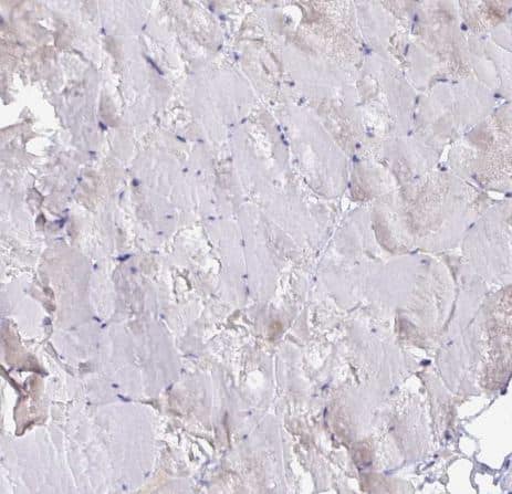 Staining of human skeletal muscle shows no positivity in myocytes as expected.