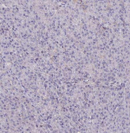 Staining of human pancreas shows no positivity in exocrine glandular cells as expected.