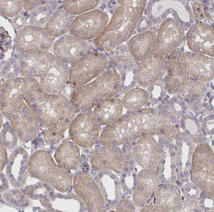 Immunohistochemistry-Paraffin: CEMP1 Antibody [NBP2-31682] - Staining of human kidney shows moderate cytoplasmic positivity in cells in tubules.