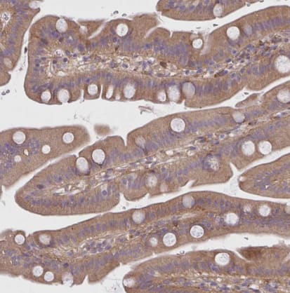 Immunohistochemistry-Paraffin: CEMP1 Antibody [NBP2-31682] - Staining of human small intestine shows moderate cytoplasmic positivity in glandular cells.