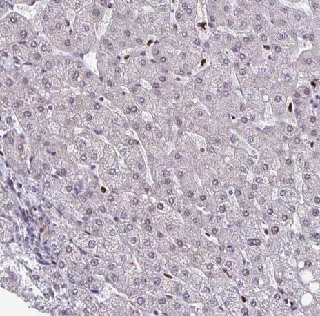 Staining of human liver shows no positivity in hepatocytes as expected.