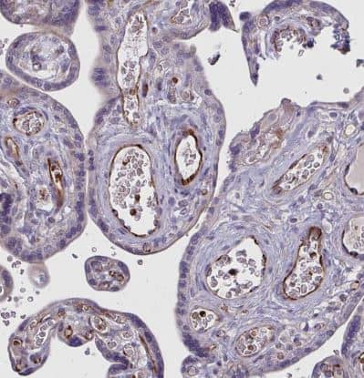 Immunohistochemistry-Paraffin: SLC14A1 Antibody [NBP2-31781] -  Staining of human placenta shows moderate cytoplasmic positivity in endothelial cells.