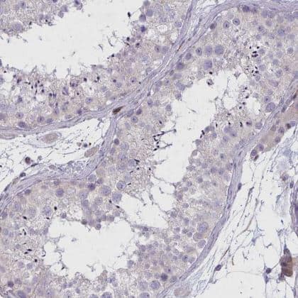 Immunohistochemistry-Paraffin: SLC14A1 Antibody [NBP2-31781] -  Staining of human testis shows no positivity in cells in seminiferous ducts as expected.