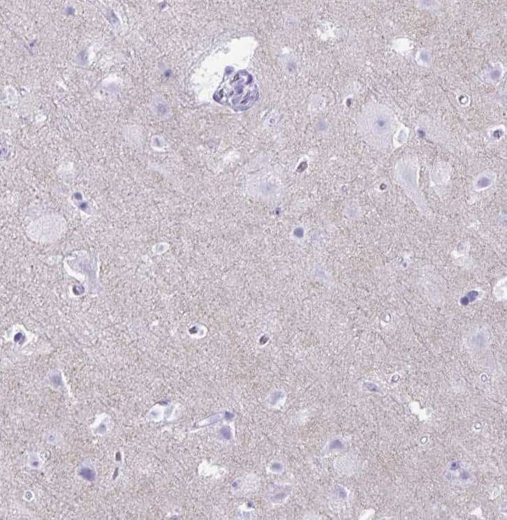 Immunohistochemistry-Paraffin: RHBDL3 Antibody [NBP2-31783] - Staining of human cerebral cortex shows weak cytoplasmic positivity in neuropil.