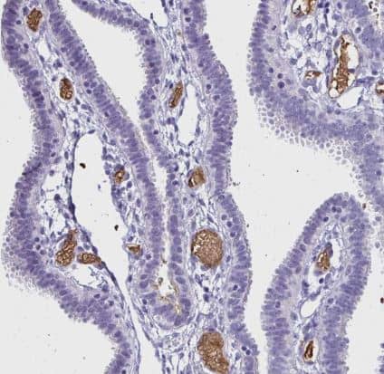 Immunohistochemistry-Paraffin: RHBDL3 Antibody [NBP2-31783] - Staining of human fallopian tube shows strong positivity in plasma.
