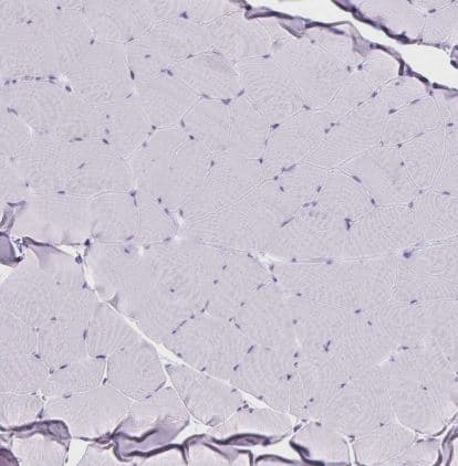Immunohistochemistry-Paraffin: RHBDL3 Antibody [NBP2-31783] - Staining of human skeletal muscle shows no positivity in myocytes as expected.