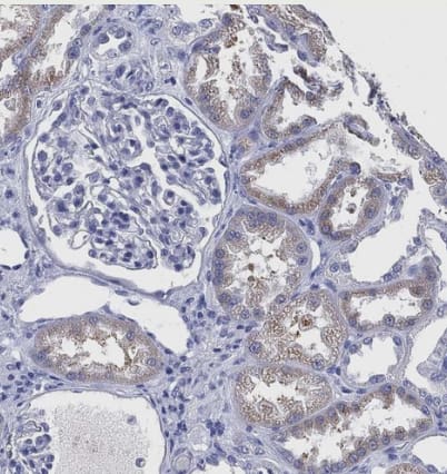 Immunohistochemistry-Paraffin: IYD Antibody [NBP2-31786] -Staining of human kidney shows moderate cytoplasmic positivity in cells in tubules.