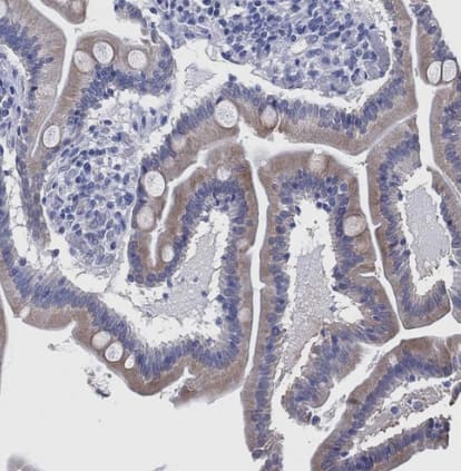 Immunohistochemistry-Paraffin: IYD Antibody [NBP2-31786] -Staining of human small intestine shows moderate cytoplasmic positivity in glandular cells.