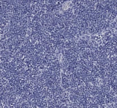 Immunohistochemistry-Paraffin: IYD Antibody [NBP2-31786] -Staining of human lymph node shows no positivity in non-germinal center cells as expected.