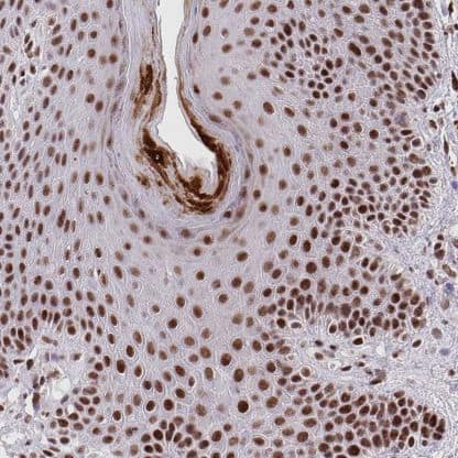 Immunohistochemistry-Paraffin: Nesprin-4 Antibody [NBP2-31811] - Staining of human skin shows strong nuclear positivity in squamous epithelial cells.