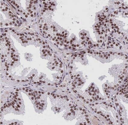 Immunohistochemistry-Paraffin: Nesprin-4 Antibody [NBP2-31811] -Staining of human prostate shows strong nuclear positivity in glandular cells.