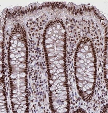 Immunohistochemistry-Paraffin: Nesprin-4 Antibody [NBP2-31811] -Staining of human colon shows moderate nuclear positivity in glandular cells.