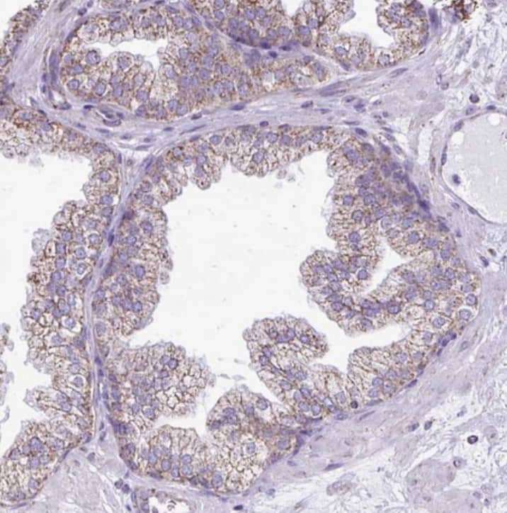  Staining of human prostate shows weak granular cytoplasmic positivity in glandular cells.