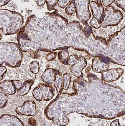 Immunohistochemistry-Paraffin: NAALADase-2/NAALAD2 Antibody [NBP2-31840] - Staining of human placenta shows strong membranous and cytoplasmic positivity in trophoblastic cells.
