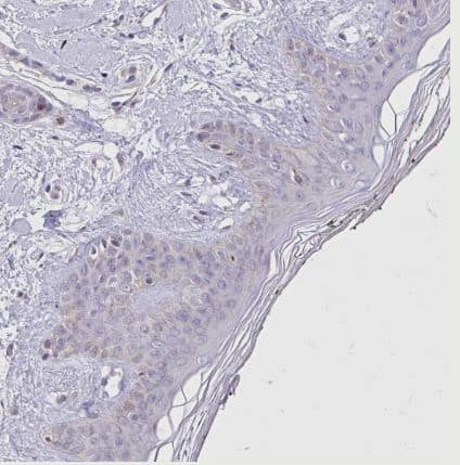 Immunohistochemistry-Paraffin: NAALADase-2/NAALAD2 Antibody [NBP2-31840] - Staining of human skin shows no cytoplasmic positivity in squamous epithelial cells as expected.