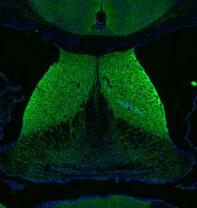Staining of mouse brain shows moderate synaptic and peri-nuclear staining in lateral septum.