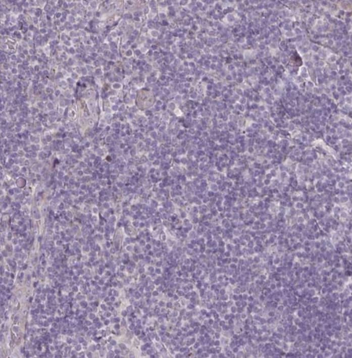 staining of human tonsil shows no positivity in non-germinal center cells as expected.