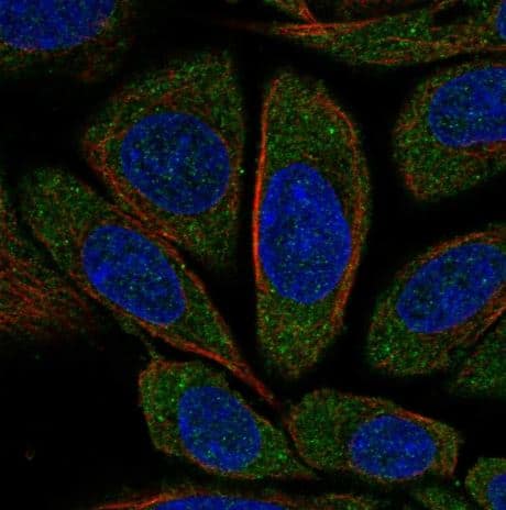 ICC/IF- CNOT1 Antibody [NBP2-31892] - Staining of human cell line SiHa shows localization to cytosol.