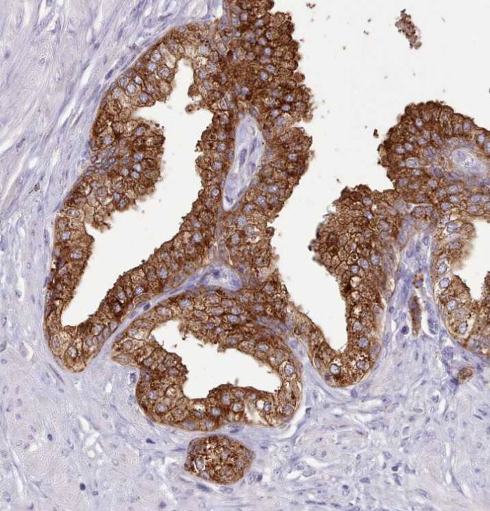  Staining of human prostate shows strong granular cytoplasmic positivity in glandular cells.