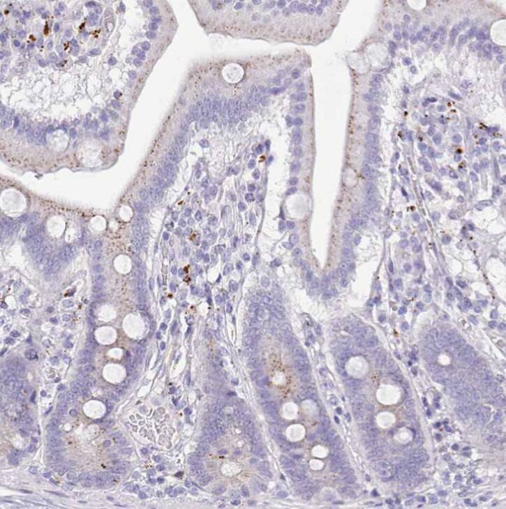 Staining of human duodenum shows weak granular cytoplasmic positivity in glandular cells.
