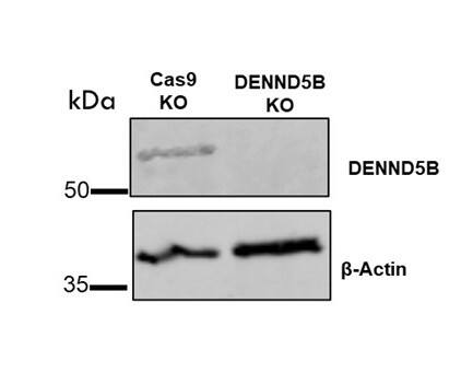 Analysis of DENND5B expression in control and DENND5B‑knockout human adipocyte cells. Primary antibody used at 1:1000 dilution. Image from a verified customer review.