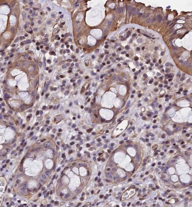 Immunohistochemistry-Paraffin SP4 Antibody - BSA Free