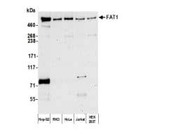 <b>Independent Antibodies Validation. </b>Western Blot: FAT1 Antibody [NBP2-32274] - : Wholecell lysate (2 ug) from Hep-G2, RKO, HeLa, Jurkat, andHEK293T cells prepared using NETN lysis buffer.Antibodies: Affinity purified rabbit anti-FAT1 antibodyused for WB at 0.04 ug/ml. Detection:Chemiluminescence with an exposure time of 3 minutes.